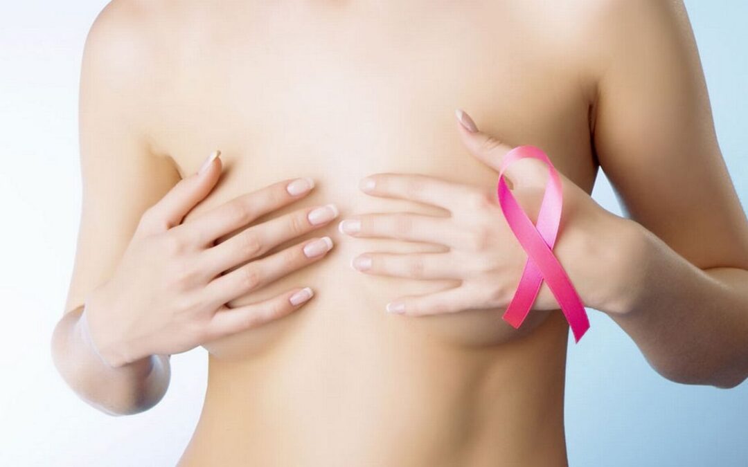 Contre le cancer du sein, simple ou double mastectomie?