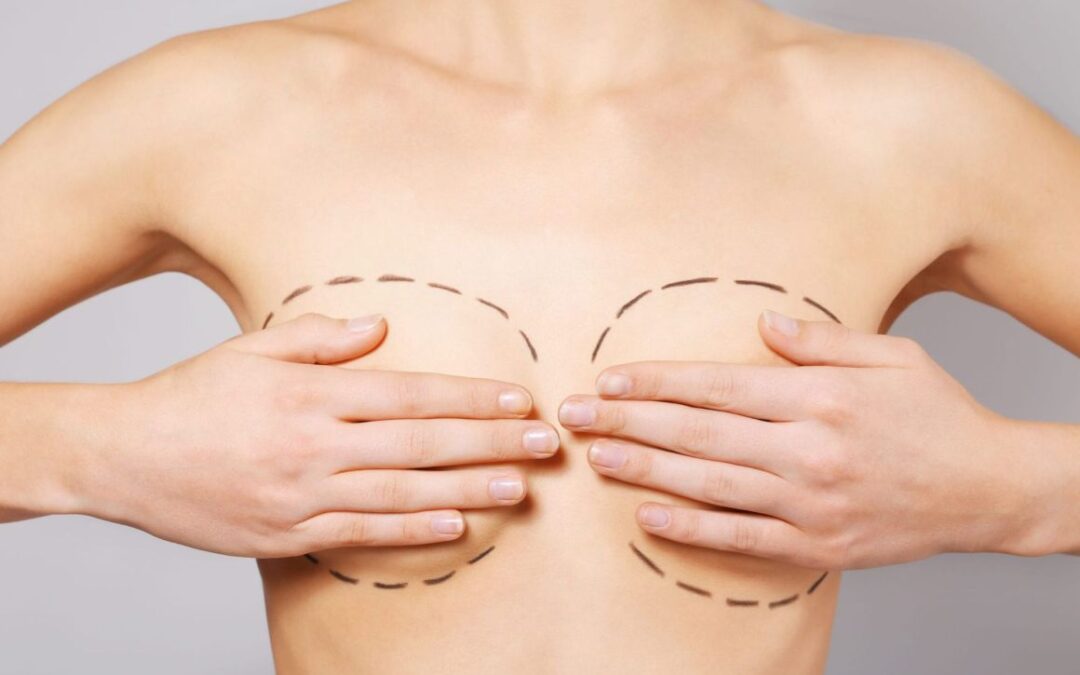 Devez-vous vous faire retirer vos implants mammaires ?